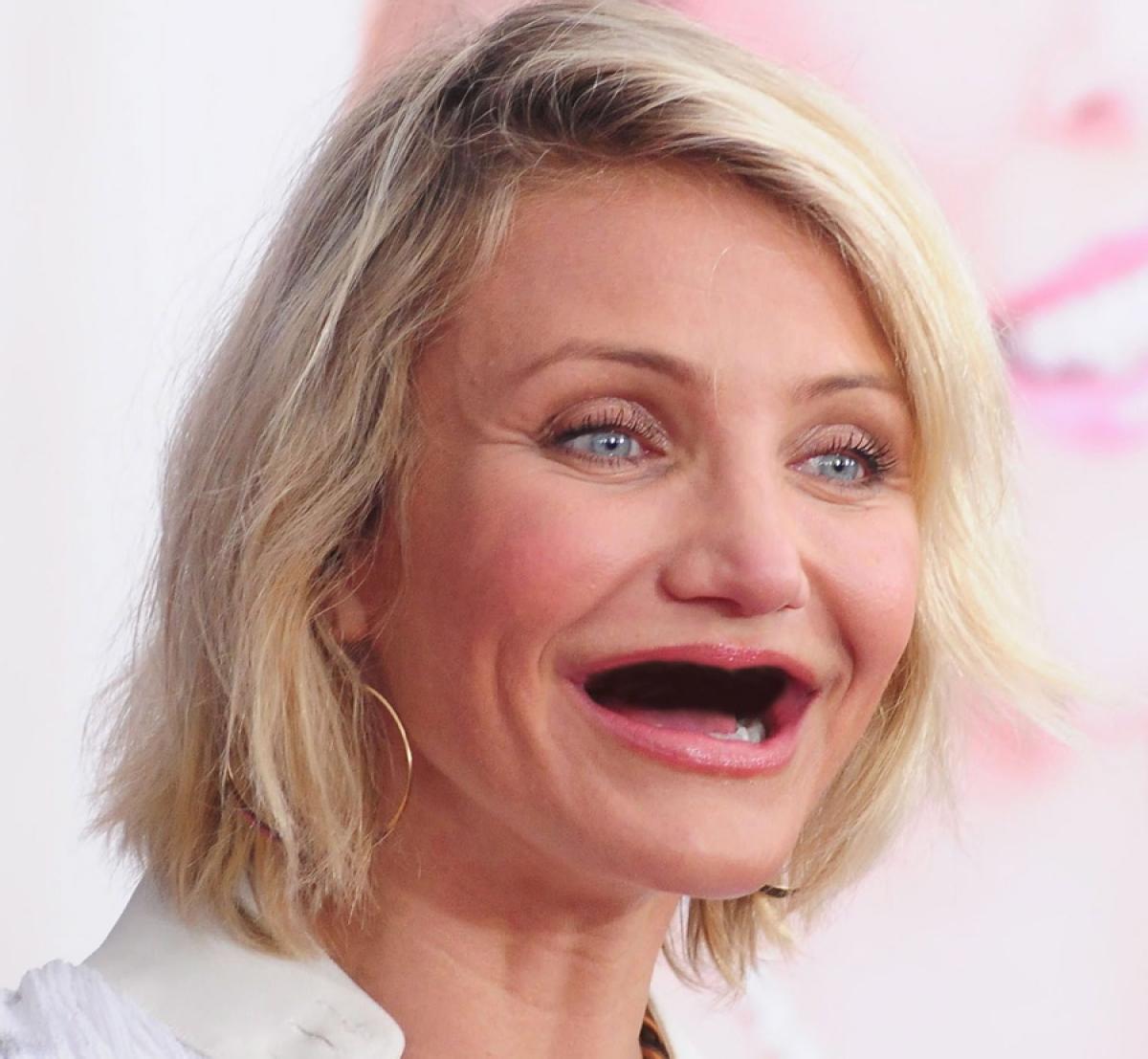 18 знаменитостей без зубов. Фотографии во славу стоматологии